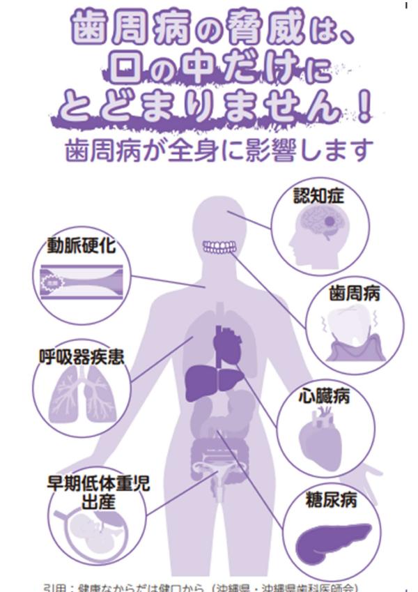 歯周病が全身に及ぼす怖い影響