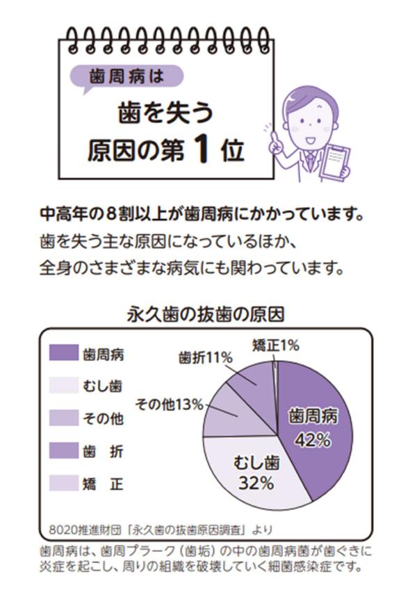 歯を失う原因第1位「歯周病」